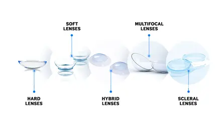 Variety of contact lenses suitable for keratoconus